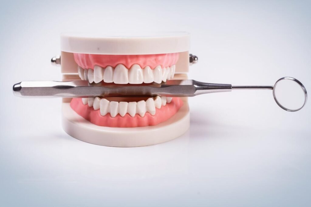 Dental Implants