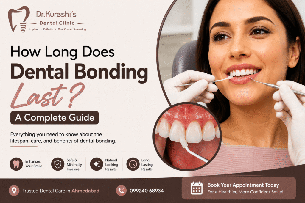 How Long Does Dental Bonding Last? A Complete Guide